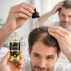 أمبولات ترويا للشعر